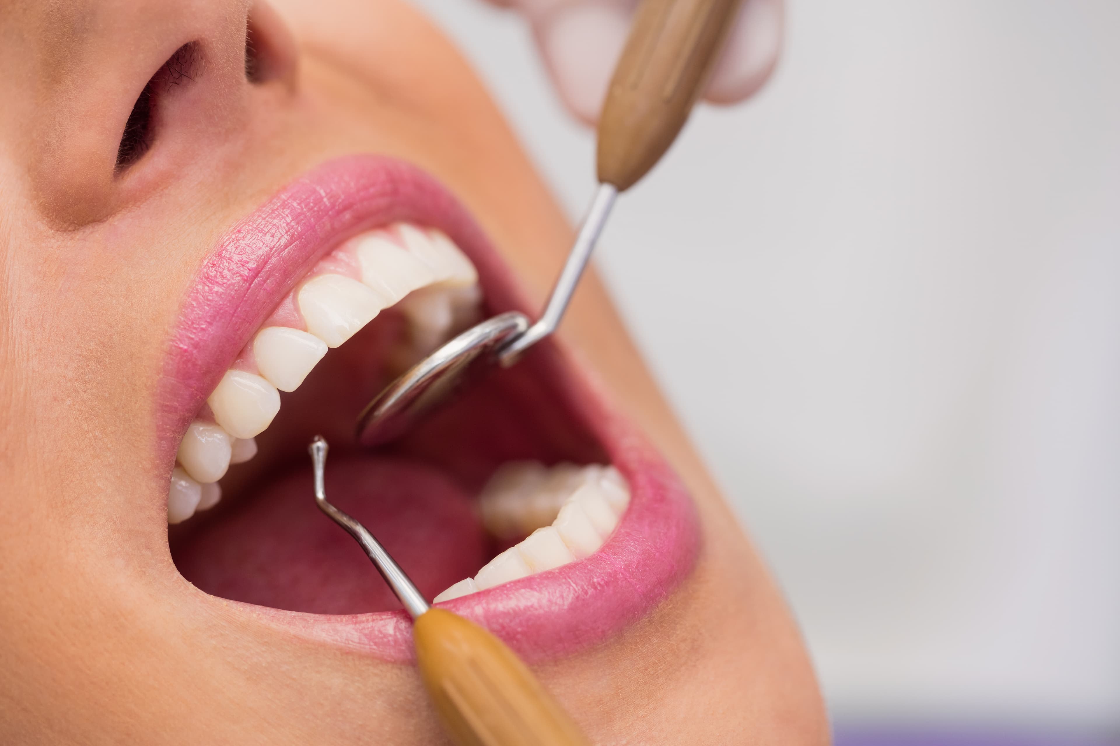 Consultation — Centre El Mostaine Dental